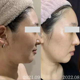 Esthe salon Blanche(エステサロンブランシュ)所属・小顔リフトアップ 美肌改善専門店のエステ・リラクイメージ