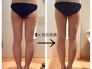 パルティール渋谷店所属・完全個室🌿✨ 痩身・小顔・美肌💖のエステ・リラクイメージ