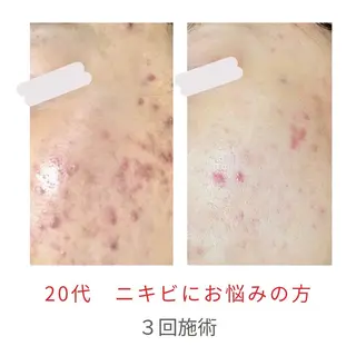 ベラージュ【美背中・ 美尻・フェイシャル】のエステ・リラクイメージ