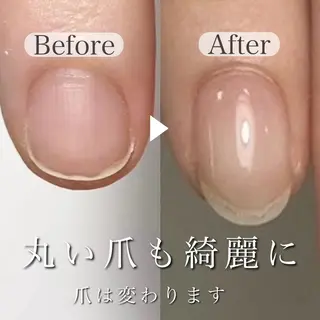 ネイル 深爪専門店 サロンリリーのネイルデザイン