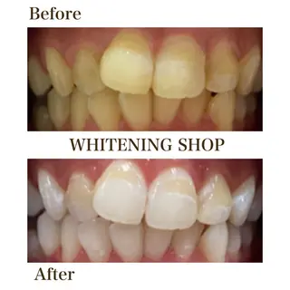 ホワイトニング ショップ川越店のエステ・リラクイメージ