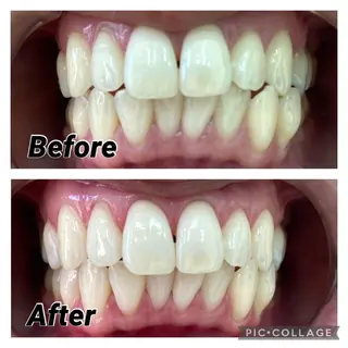 セルフホワイトニングCOCOSHIRO所属・セルフホワイトニング COCOSHIROのエステ・リラクイメージ