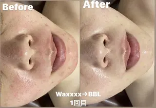 Epina 千葉店 【エピナ】のエステ・リラクイメージ