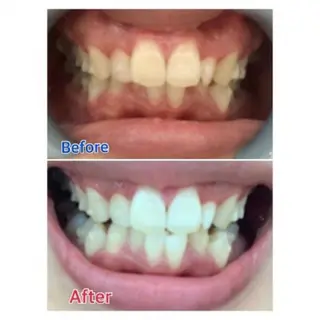 M渋谷店所属・Ｍ渋谷 ホワイトニングのエステ・リラクイメージ