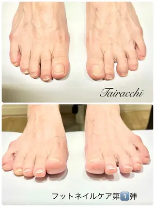 ネイル Tairacchi ﾀｲﾗｯﾁのエステ・リラクイメージ