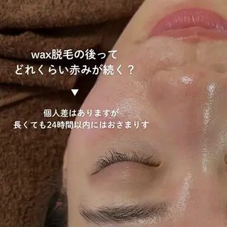 EST BEAUTY所属・顔ワックス脱毛/ ハーブピーリングのエステ・リラクイメージ