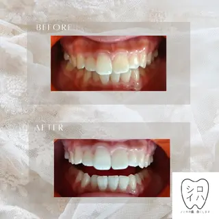 ホワイトニングサロン シロイハ所属・歯を白くしたい方🦷 シロイハのその他イメージ