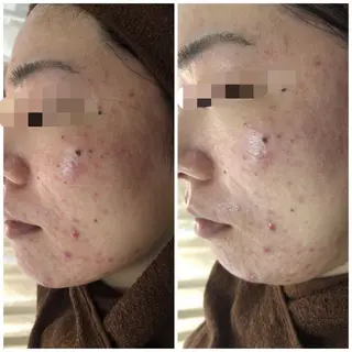 ロング カラー パーマ ヘアアレンジ メンズ キッズ ネイル マツエク・マツパ Amaryllis 🌹のエステ・リラクイメージ