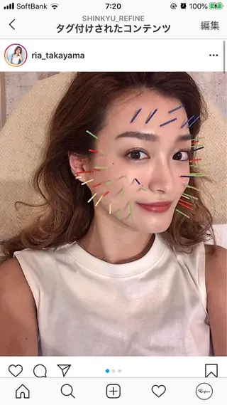 鍼灸整骨院Refine所属・鍼灸 Refineのその他イメージ