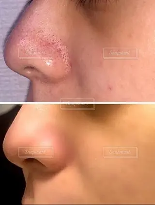 オーガニック エステ サロンフィオーレの眉毛・アイブロウイメージ