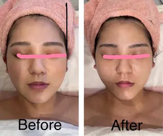 韓国肌管理ララピール 小顔リフト/LDMのエステ・リラクイメージ