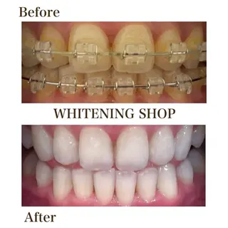 ホワイトニングショップ津店所属・ホワイトニング ショップ津店のその他イメージ