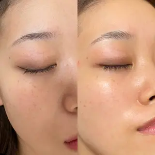 麻生 nico… ayakaのマツエク・マツパデザイン