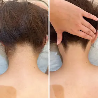 うなじ脱毛/美肌脱毛 LABELのエステ・リラクイメージ