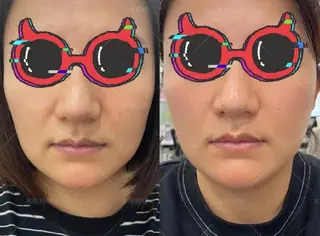 aliaハイフ&水光ジェットサロン所属・aliaハーブ水光店 エステティシャン募集のエステ・リラクイメージ