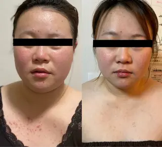 結果重視の温活美容 CARNAのエステ・リラクイメージ