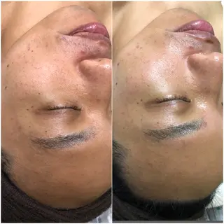 メンズ Chio-RE所属・Wax/絹肌艶肌🌼 坂結加のエステ・リラクイメージ