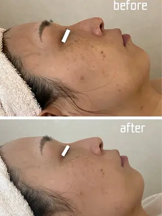 Alluring（アルーリング）所属・Alluring アルーリング中村のエステ・リラクイメージ