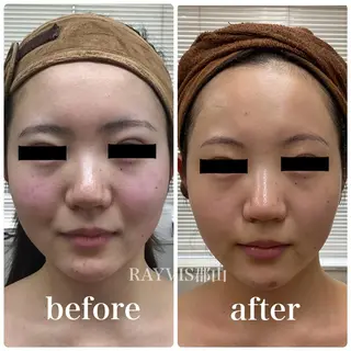 🩵RAYVIS🩵 郡山店のエステ・リラクイメージ