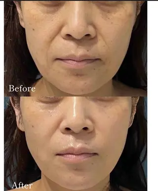 Total Beauty salon Bloom所属・肌育WISHpro 専門サロンBloomのエステ・リラクイメージ