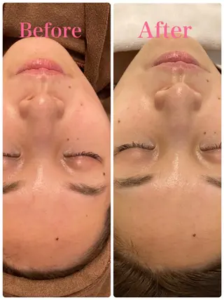 Dione 銀座本店のエステ・リラクイメージ