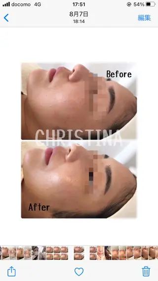 肌質改善サロンChouChou所属・肌質改善サロン chouchouのエステ・リラクイメージ