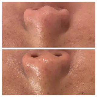 肌質改善フェイシャルCLEAR栄生/リンパ/毛穴/シミケア所属・井戸 麻衣のエステ・リラクイメージ