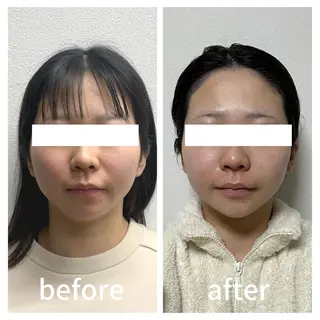 小顔サロン AMYONのエステ・リラクイメージ