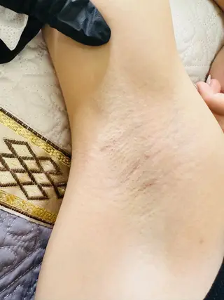 Thu Huyen Beauty所属・トウ フェンのエステ・リラクイメージ