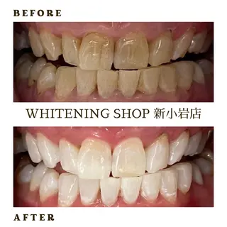 メンズ ホワイトニング ショップ新小岩店のその他イメージ