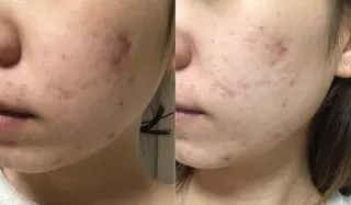 in you所属・in you三軒茶屋 YUKOのエステ・リラクイメージ