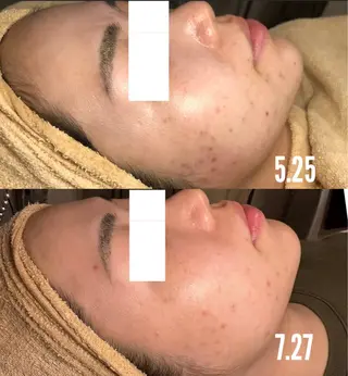 a room salonのエステ・リラクイメージ