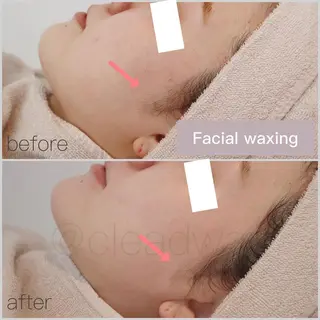 CLEAD 赤坂見附店のエステ・リラクイメージ