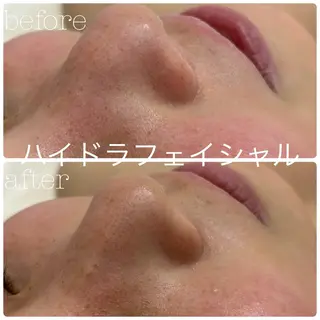 フェイシャルサロン CHIARA 荒田のエステ・リラクイメージ