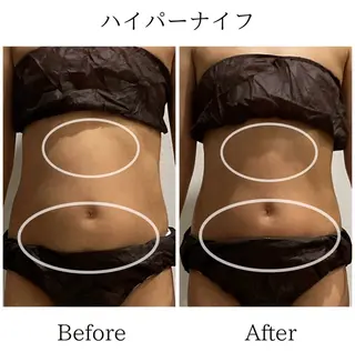 LiLL by Andre beauty所属・LiLL 熊本のエステ・リラクイメージ