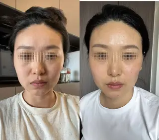 aliaハイフ&水光ジェットサロン所属・aliaハーブ水光店 エステティシャン募集のエステ・リラクイメージ