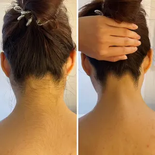 うなじ脱毛/美肌脱毛 LABELのエステ・リラクイメージ