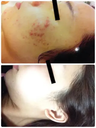 都度払い肌質改善 &脱毛Blancheのエステ・リラクイメージ