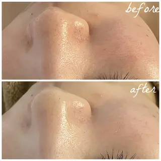 メンズ メナード岐阜茜部 杉浦のエステ・リラクイメージ