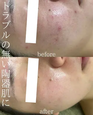 韓国美肌/肌質改善 【天神】yuiのエステ・リラクイメージ