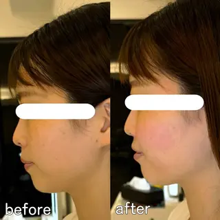 小顔矯正&美容整体 整え屋REDオーナーのエステ・リラクイメージ