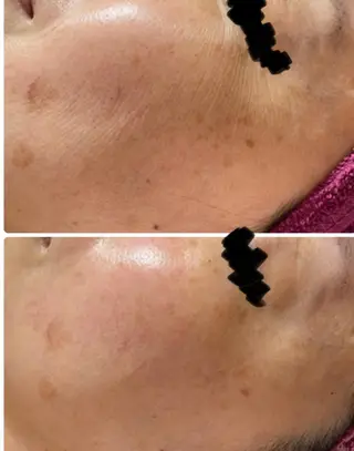 eye lash Lapisのマツエク・マツパデザイン