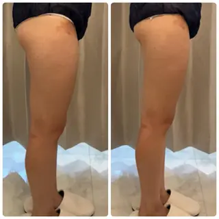 FLEUR 2号店のエステ・リラクイメージ