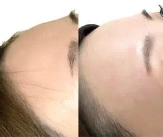 小顔/たるみ/黒ずみ除去専門サロン/SONA 大和西大寺店所属・【小顔専門看護師 サロンSONA】のエステ・リラクイメージ