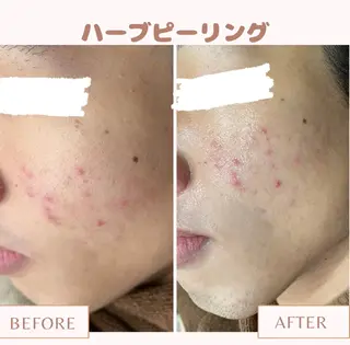 メンズ キッズ Amaryllis 💜河田のエステ・リラクイメージ