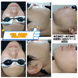 メンズ 武 藤のエステ・リラクイメージ