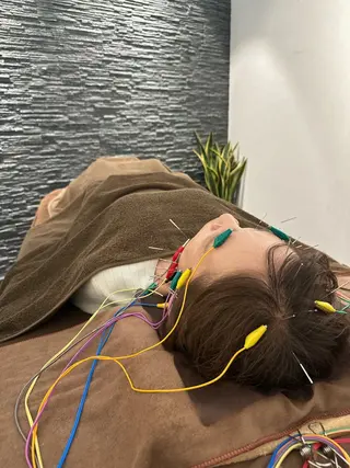 美容鍼灸整体サロンBeauJu所属・小顔矯/美容鍼/鍼灸 BeauJuのその他イメージ