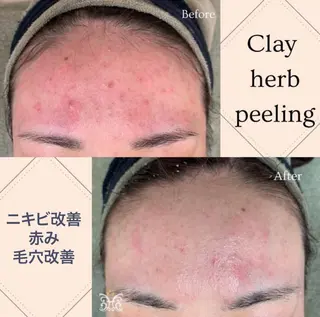 美肌&アロマ🌸 nana 中目黒のエステ・リラクイメージ