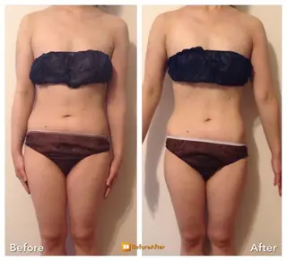 小尻・太もも痩せる エステルナボーテのエステ・リラクイメージ