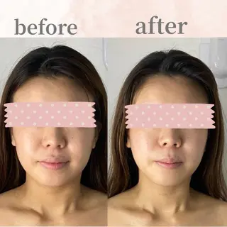 hitohana所属・毛穴/いちご鼻/小顔 /hitohanaのエステ・リラクイメージ